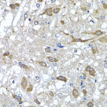 IHC-P analysis of rat brain tissue using GTX32768 OSGEPL1 antibody. Dilution : 1:100