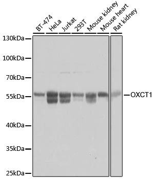 WB analysis of various sample lysates using GTX32770 OXCT1 antibody. Dilution : 1:3000 Loading : 25microg per lane