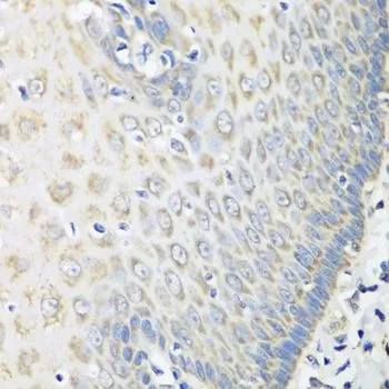 IHC-P analysis of human esophagus tissue using GTX32770 OXCT1 antibody. Dilution : 1:100