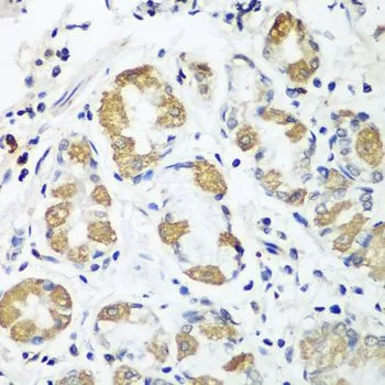 IHC-P analysis of human stomach tissue using GTX32770 OXCT1 antibody. Dilution : 1:100