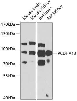 WB analysis of various sample lysates using GTX32774 PCDHA13 antibody. Dilution : 1:1000 Loading : 25microg per lane WB analysis of various sample lysates using GTX32774 PCDHA13 antibody. Dilution : 1:1000 Loading : 25microg per lane