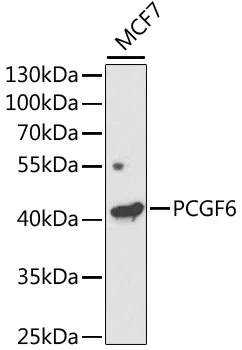 WB analysis of MCF7 cell lysate using GTX32775 PCGF6 antibody. The signal was developed with ECL plus-Enhanced. Dilution : 1:1000 Loading : 25microg per lane WB analysis of MCF7 cell lysate using GTX32775 PCGF6 antibody. The signal was developed with ECL plus-Enhanced. Dilution : 1:1000 Loading : 25microg per lane