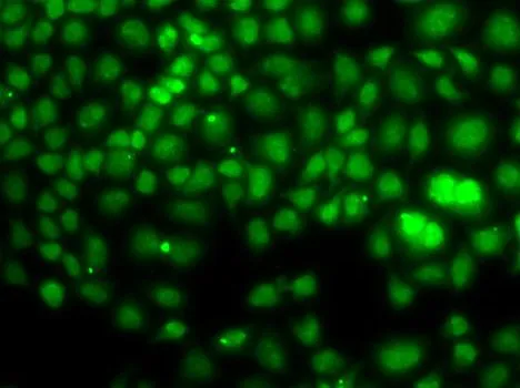 ICC/IF analysis of U2OS cells using GTX32775 PCGF6 antibody.