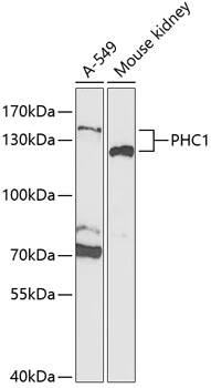 WB analysis of various sample lysates using GTX32784 PHC1 antibody. The signal was developed with ECL plus-Enhanced. Dilution : 1:1000 Loading : 25microg per lane WB analysis of various sample lysates using GTX32784 PHC1 antibody. The signal was developed with ECL plus-Enhanced. Dilution : 1:1000 Loading : 25microg per lane