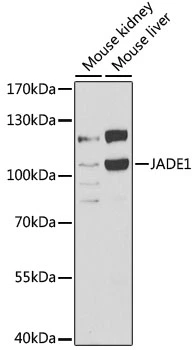 WB analysis of various sample lysates using GTX32786 PHF17 antibody. Dilution : 1:1000 Loading : 25microg per lane WB analysis of various sample lysates using GTX32786 PHF17 antibody. Dilution : 1:1000 Loading : 25microg per lane