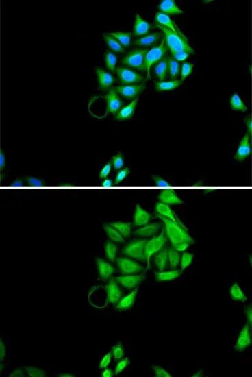 ICC/IF analysis of U2OS cells using GTX32786 PHF17 antibody. Blue : DAPI