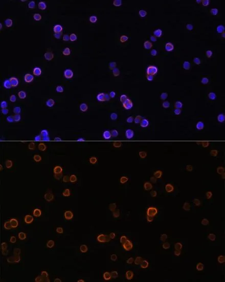 ICC/IF analysis of Raw264.7 cells using GTX32793 PLCG2 antibody. Blue : DAPI Dilution : 1:100