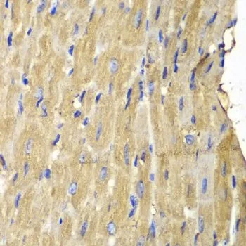 IHC-P analysis of mouse heart tissue using GTX32793 PLCG2 antibody. Dilution : 1:100