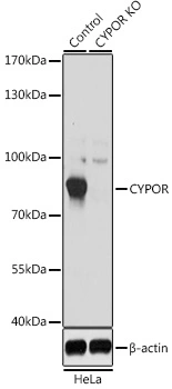 WB analysis of normal (control) and knockout (KO) HeLa cell lysate using GTX32801 POR antibody. Dilution : 1:1000 Loading : 25microg per lane WB analysis of normal (control) and knockout (KO) HeLa cell lysate using GTX32801 POR antibody. Dilution : 1:1000 Loading : 25microg per lane