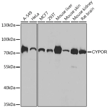 WB analysis of various sample lysates using GTX32801 POR antibody. Dilution : 1:1000 Loading : 25microg per lane
