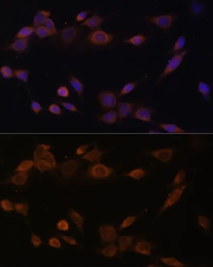 ICC/IF analysis of NIH/3T3 cells using GTX32801 POR antibody. Blue : DAPI Dilution : 1:100