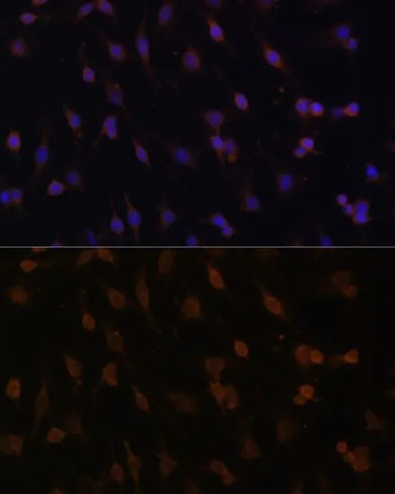 ICC/IF analysis of C6 cells using GTX32801 POR antibody. Blue : DAPI Dilution : 1:100