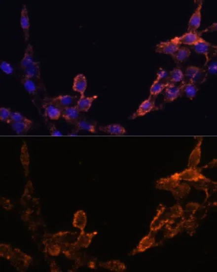 ICC/IF analysis of HeLa cells using GTX32801 POR antibody. Blue : DAPI Dilution : 1:100