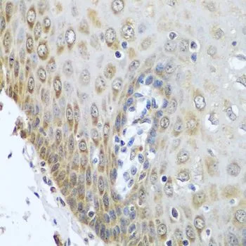 IHC-P analysis of human esophagus tissue using GTX32801 POR antibody. Dilution : 1:100