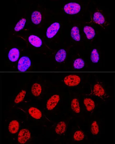 ICC/IF analysis of U2OS cells using GTX32803 PPAR gamma antibody. Blue : DAPI Dilution : 1:200