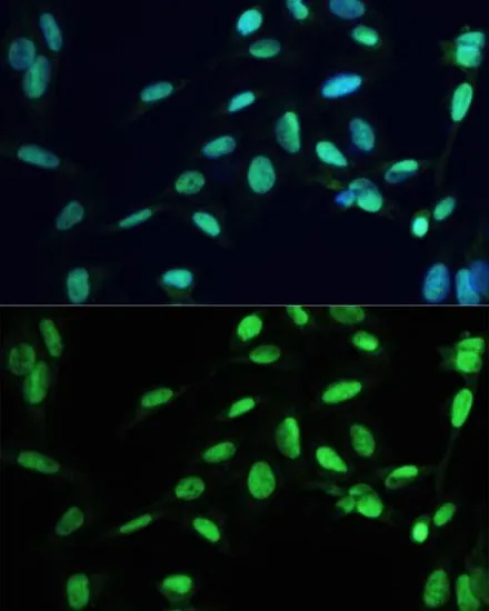 ICC/IF analysis of U2OS cells using GTX32803 PPAR gamma antibody. Blue : DAPI Dilution : 1:100