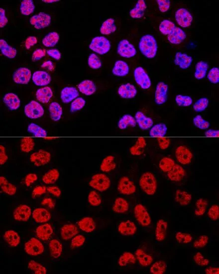 ICC/IF analysis of HeLa cells using GTX32803 PPAR gamma antibody. Blue : DAPI Dilution : 1:200