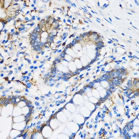 IHC-P analysis of human colon tissue using GTX32803 PPAR gamma antibody. Dilution : 1:100