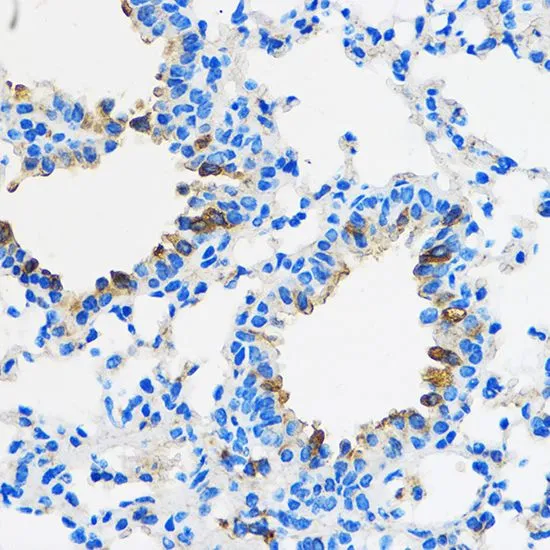 IHC-P analysis of mouse lung tissue using GTX32803 PPAR gamma antibody. Dilution : 1:100
