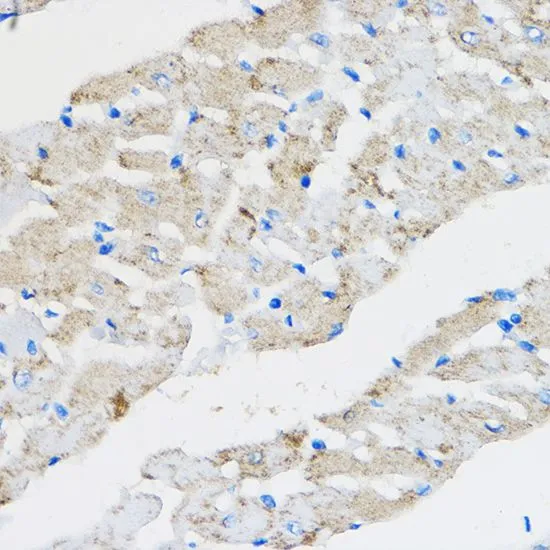 IHC-P analysis of rat heart tissue using GTX32803 PPAR gamma antibody. Dilution : 1:100