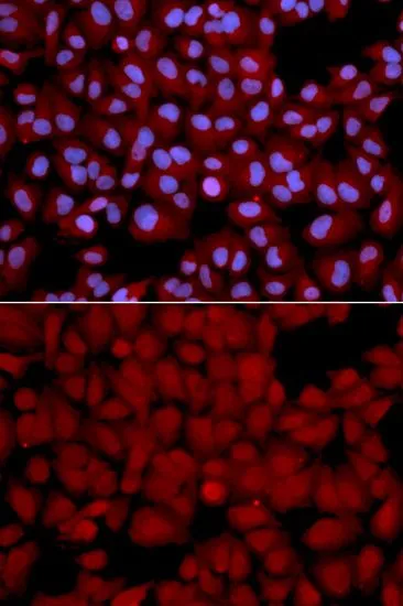 ICC/IF analysis of U2OS cells using GTX32804 PPP1CB antibody. Blue : DAPI