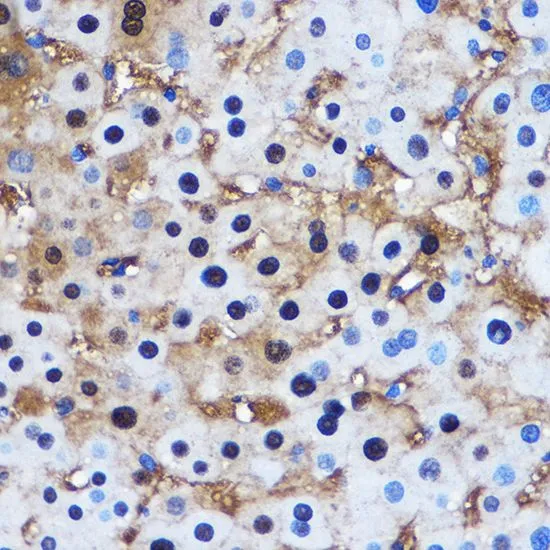 IHC-P analysis of human liver tissue using GTX32804 PPP1CB antibody. Dilution : 1:100