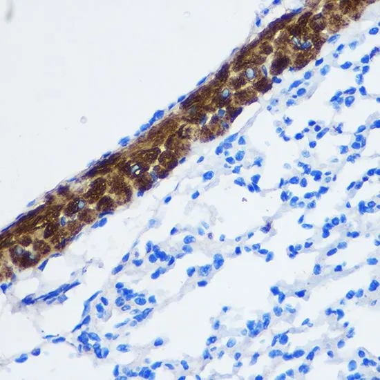 IHC-P analysis of mouse lung tissue using GTX32804 PPP1CB antibody. Dilution : 1:100