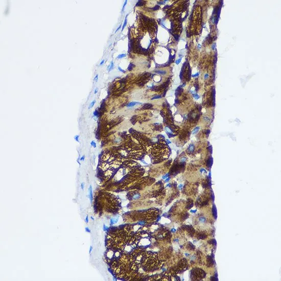 IHC-P analysis of rat lung tissue using GTX32804 PPP1CB antibody. Dilution : 1:100