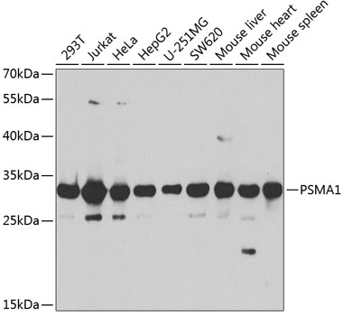 WB analysis of various sample lysates using GTX32814 Proteasome 20S alpha 1 antibody. Dilution : 1:1000 Loading : 25microg per lane WB analysis of various sample lysates using GTX32814 Proteasome 20S alpha 1 antibody. Dilution : 1:1000 Loading : 25microg per lane