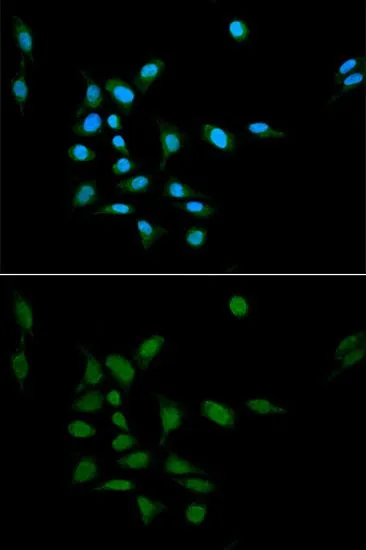 ICC/IF analysis of U2OS cells using GTX32814 Proteasome 20S alpha 1 antibody. Blue : DAPI Dilution : 1:100
