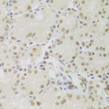 IHC-P analysis of mouse brain tissue using GTX32816 PRPF3 antibody. Dilution : 1:100