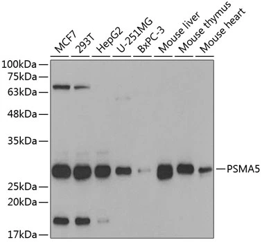 WB analysis of various sample lysates using GTX32817 PSMA5 antibody. Dilution : 1:1000 Loading : 25microg per lane WB analysis of various sample lysates using GTX32817 PSMA5 antibody. Dilution : 1:1000 Loading : 25microg per lane