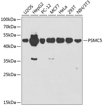 WB analysis of various sample lysates using GTX32819 PSMC5 antibody. Dilution : 1:1000 Loading : 25microg per lane WB analysis of various sample lysates using GTX32819 PSMC5 antibody. Dilution : 1:1000 Loading : 25microg per lane