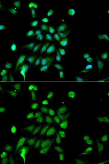 ICC/IF analysis of MCF7 cells using GTX32819 PSMC5 antibody. Blue : DAPI