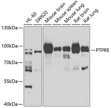 WB analysis of various sample lysates using GTX32824 PTPRE antibody. Dilution : 1:1000 Loading : 25microg per lane WB analysis of various sample lysates using GTX32824 PTPRE antibody. Dilution : 1:1000 Loading : 25microg per lane