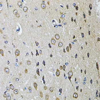 IHC-P analysis of rat brain tissue using GTX32824 PTPRE antibody. Dilution : 1:100