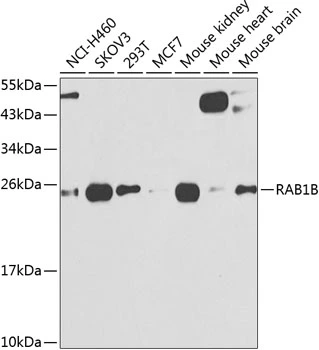 WB analysis of various sample lysates using GTX32825 RAB1B antibody. Dilution : 1:1000 Loading : 25microg per lane WB analysis of various sample lysates using GTX32825 RAB1B antibody. Dilution : 1:1000 Loading : 25microg per lane