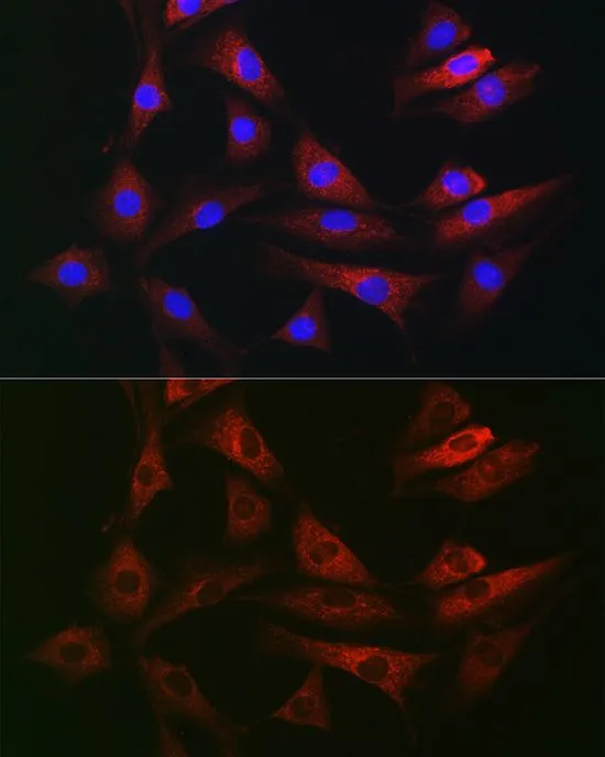 ICC/IF analysis of NIH/3T3 cells using GTX32825 RAB1B antibody. Blue : DAPI Dilution : 1:100