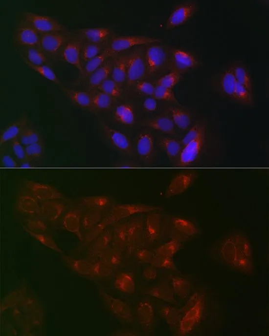 ICC/IF analysis of U2OS cells using GTX32825 RAB1B antibody. Blue : DAPI Dilution : 1:100