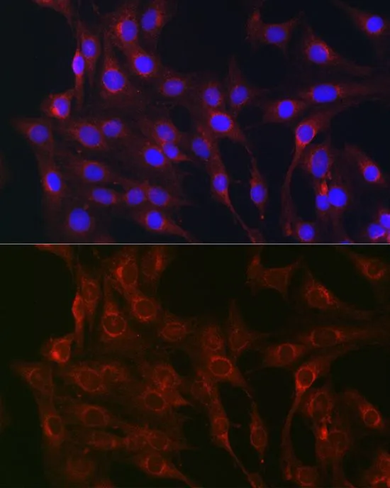 ICC/IF analysis of C6 cells using GTX32825 RAB1B antibody. Blue : DAPI Dilution : 1:100