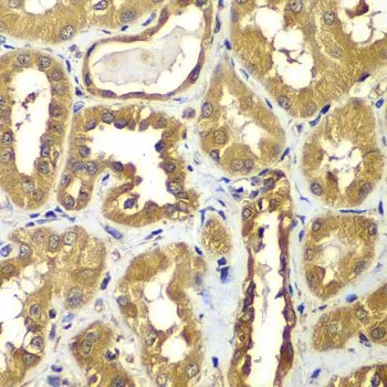 IHC-P analysis of human kidney tissue using GTX32825 RAB1B antibody. Dilution : 1:100