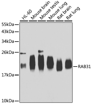 WB analysis of various sample lysates using GTX32827 RAB31 antibody. Dilution : 1:1000 Loading : 25microg per lane WB analysis of various sample lysates using GTX32827 RAB31 antibody. Dilution : 1:1000 Loading : 25microg per lane