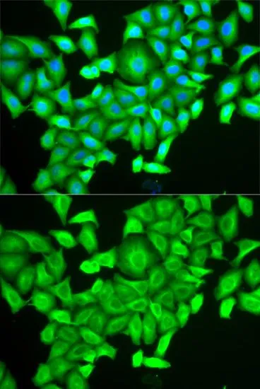 ICC/IF analysis of HeLa cells using GTX32829 RAB6A antibody. Blue : DAPI