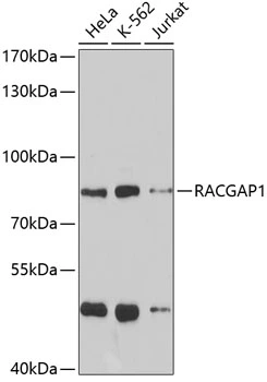 WB analysis of various sample lysates using GTX32831 RACGAP1 antibody. Dilution : 1:1000 Loading : 25microg per lane WB analysis of various sample lysates using GTX32831 RACGAP1 antibody. Dilution : 1:1000 Loading : 25microg per lane