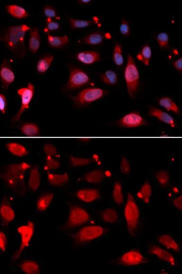 ICC/IF analysis of U2OS cells using GTX32831 RACGAP1 antibody. Blue : DAPI