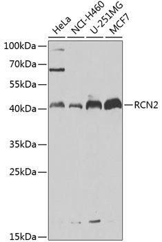 WB analysis of various sample lysates using GTX32836 RCN2 antibody. Dilution : 1:1000 Loading : 25microg per lane WB analysis of various sample lysates using GTX32836 RCN2 antibody. Dilution : 1:1000 Loading : 25microg per lane