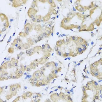 IHC-P analysis of human stomach tissue using GTX32836 RCN2 antibody. Dilution : 1:100