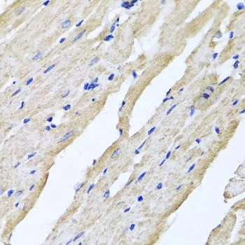 IHC-P analysis of rat heart tissue using GTX32836 RCN2 antibody. Dilution : 1:100