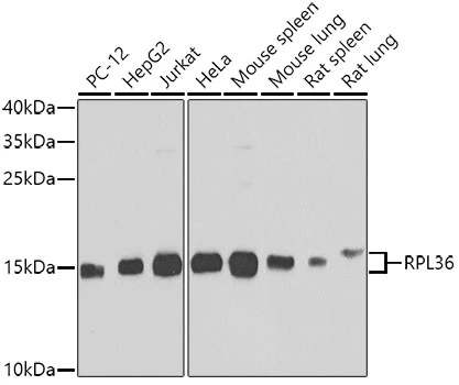 WB analysis of various sample lysates using GTX32847 RPL36 antibody. Dilution : 1:1000 Loading : 25microg per lane WB analysis of various sample lysates using GTX32847 RPL36 antibody. Dilution : 1:1000 Loading : 25microg per lane