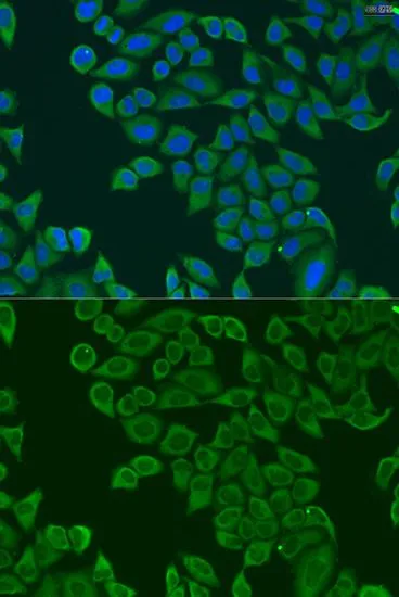 ICC/IF analysis of U2OS cells using GTX32847 RPL36 antibody. Blue : DAPI Dilution : 1:100